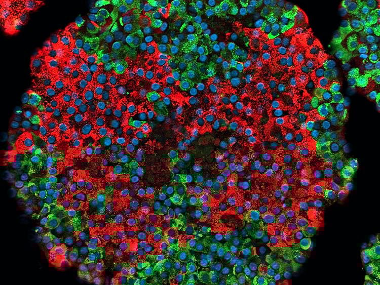  Picture of a stem cell-derived pancreatic islet. Insulin-producing cells are in red while glucagon-producing cells are in green