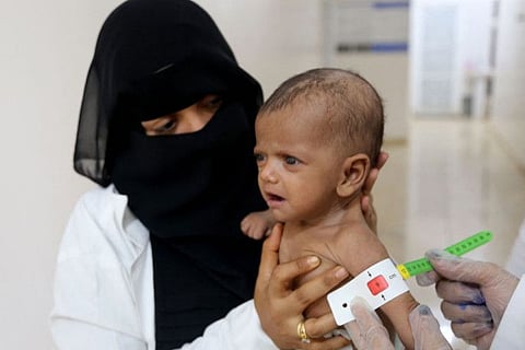 Nurses examine a malnourished child at a treatment centre in the Khokha district of the western province of Hodeida on March 11, 2023. The UN estimates that 21.6 million people - two-thirds of Yemen's population - will require humanitarian aid and protection services in 2023. 
