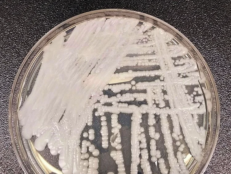 20232103 candida auris