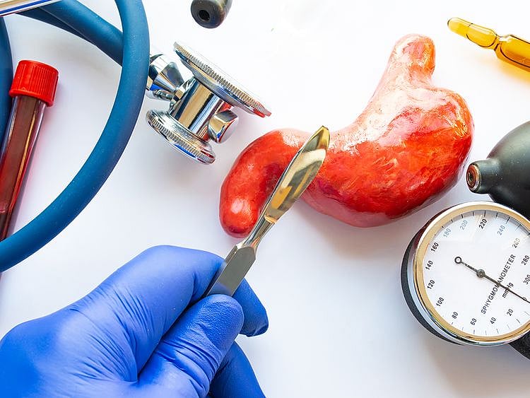 Bariatric surgeries_LEAD STORY_MAIN