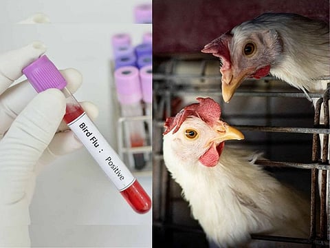 A Louisiana patient with exposure to sick and dead birds in backyard flocks has been hospitalised with bird flu.