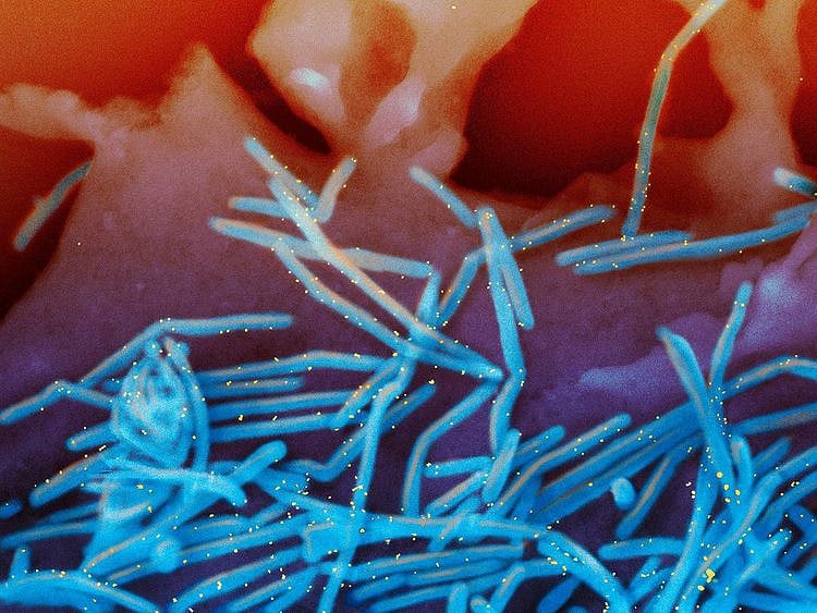 human respiratory syncytial virus (RSV) virions