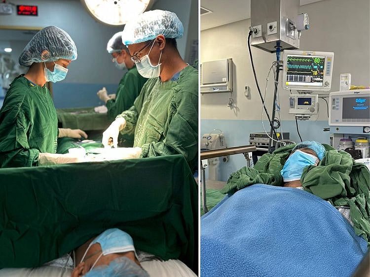 Surgery Appendectomy