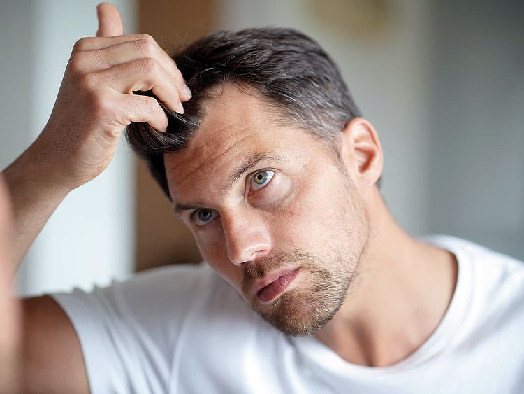 hair loss stock