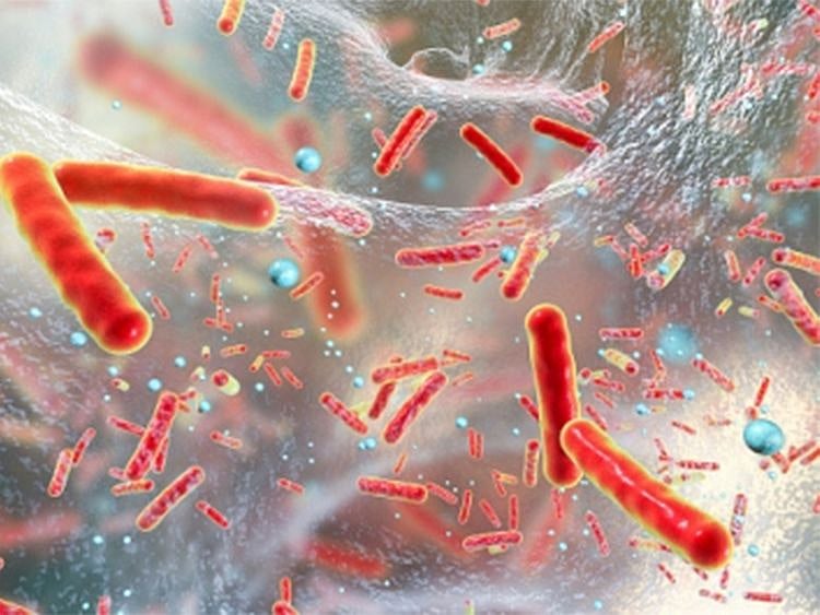 superbug