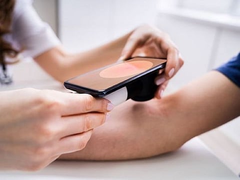 Performing regular skin self-checks is important for everyone, especially if you fall in the high-risk zone.