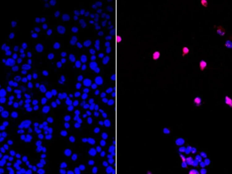 cancer-killing pill AOH1996 suppresses tumor growth as a monotherapy or as a combination treatment but causes no discernable side effects.