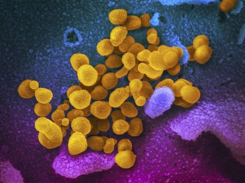 The new study is based on electronic medical records from VA databases of nearly 139,000 military veterans diagnosed with COVID early in the pandemic, from March 2020 through the end of that year.