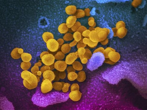The new study is based on electronic medical records from VA databases of nearly 139,000 military veterans diagnosed with COVID early in the pandemic, from March 2020 through the end of that year.