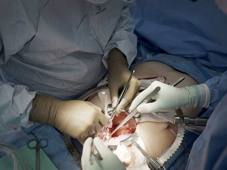 Surgeons at NYU Langone Health prepare to transplant a pig's kidney into a brain-dead man in New York
