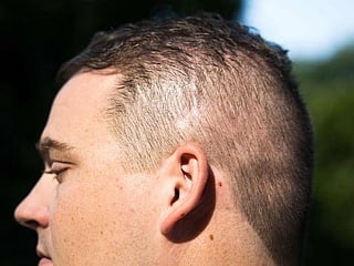 From 'magical' to 'rip it out': different brain implant experiences