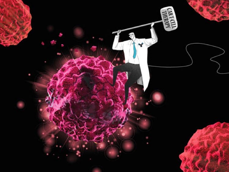 CAR T cell therapy-1695101624933