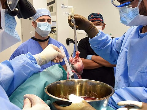 In this photo provided by the University of Maryland School of Medicine, surgeons prepare for a pig heart transplant into Lawrence Faucette at the school's hospital in Baltimore. Two days after the transplant, Faucette was cracking jokes and able to sit in a chair, doctors said. 