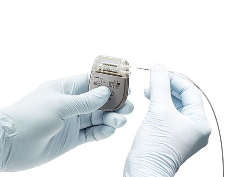 This image shows the insertion of the lead electrodes into the Neurostimulator (IPG). The stimulator, implanted in the abdomen, connected to electrodes used to stimulate the spinal cord of paralysed patients to help them regain movement.  