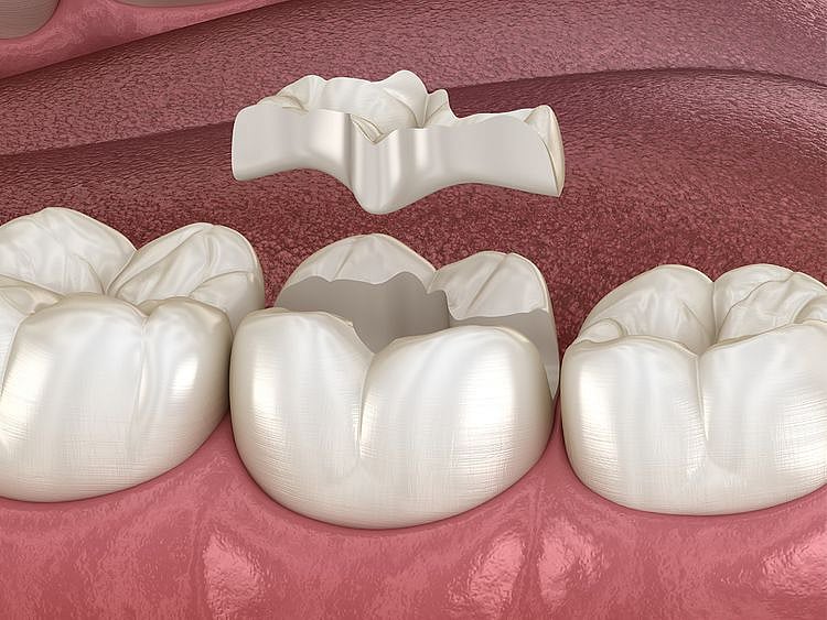 Dental care_new article