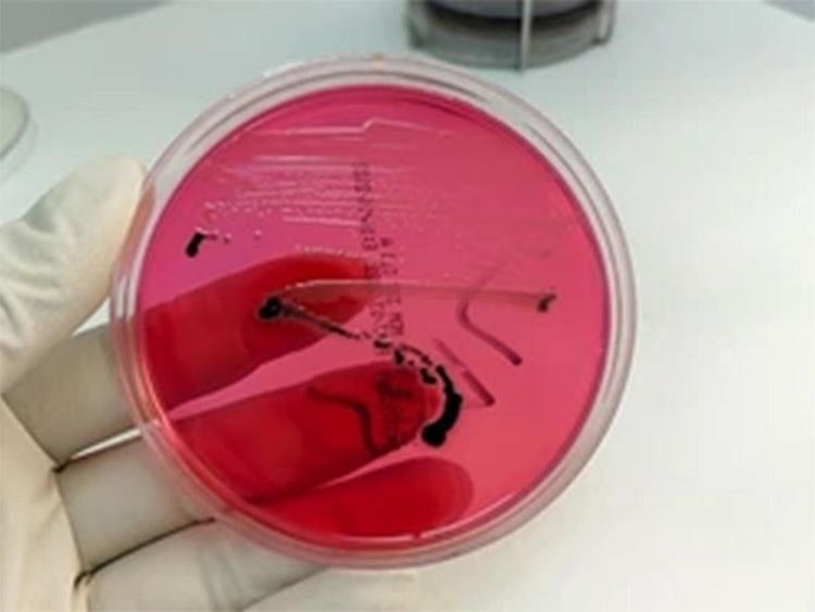 Salmonella