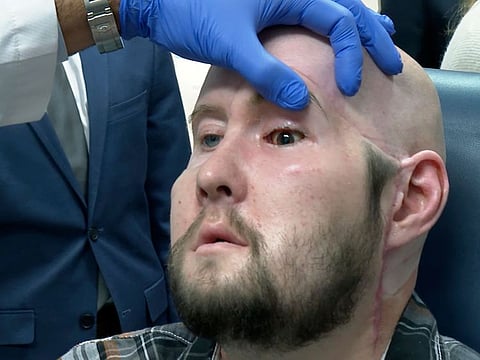 Dr. Eduardo Rodriguez, NYU Langone Health's chair of plastic surgery, examines Aaron James in New York on Oct. 23, 2023.