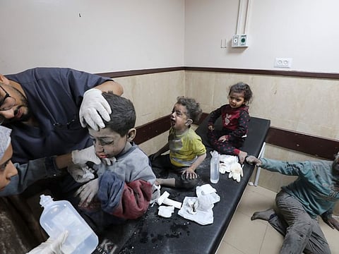 Palestinian children wounded in the Israeli bombardment of the Gaza Strip are treated at Al Aqsa Hospital on Deir Al Balah, Gaza Strip on November 21, 2023.  