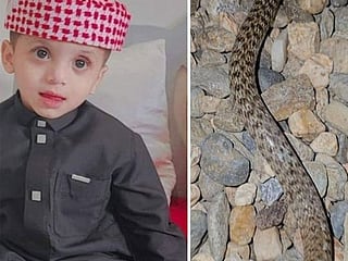 Saudi Arabia: Three-year-old survives snake bite while playing in the yard