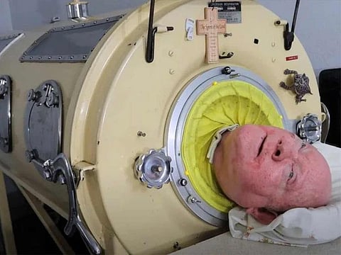 Paul Alexander of Dallas, Texas contracted polio at the age of six, leaving him paralysed from the neck down and reliant on a mechanical respirator to breathe.