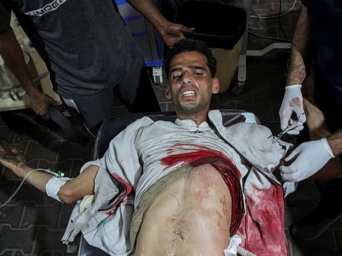 A Palestinian man wounded in an Israeli strike reacts as he receives treatment at a hospital in Rafah, in the southern Gaza Strip, on May 9, 2024.  