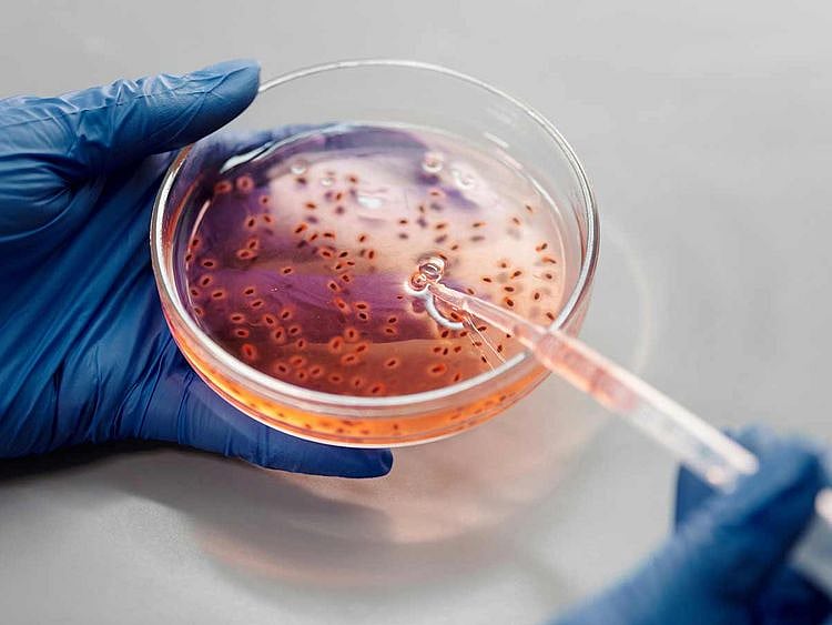 Brazil records world's first Oropouche virus deaths