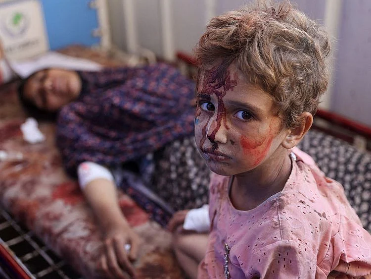An injured child sits next to a woman at Al Ahli Arab hospital, also known as the Baptist hospital in Gaza City following Israeli bombardment on the Hassan Salameh and Al Nassr schools housing displaced Palestinians on August 4, 2024.