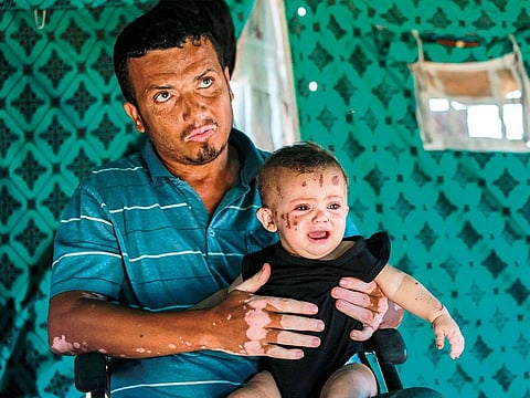 Palestinian toddler Rim Abu Hayya, the sole survivor from her family after they were killed by reported Israeli bombardment that hit their house in the east of Khan Yunis, is carried by her uncle Jalal.