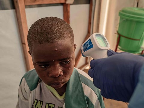 A patient has his temperature taken at the Mpox treatment centre at Nyiragongo General Referral Hospital, north of Goma on August 17, 2024.  