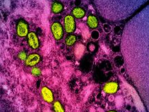 A colorized transmission electron micrograph of monkeypox particles (green) found within an infected cell (pink and purple), cultured in the laboratory. 