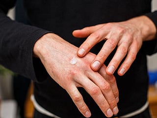 Scaly, dry skin can quickly become itchy and irritating. Deal with your eczema with specially made products that are gentle but effective.