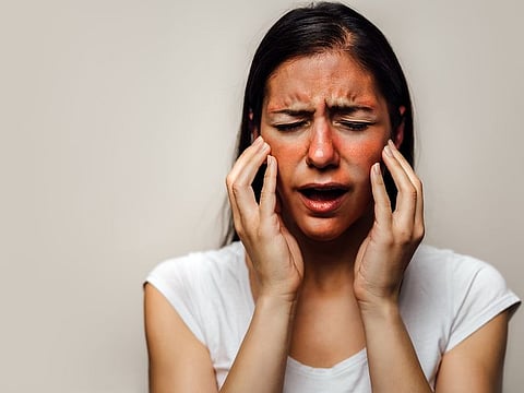 These rays penetrate the skin at different depths, with UVA penetrating deeper and contributing to more persistent allergies like polymorphous light eruption (PMLE). For some, even small amounts of UV exposure are enough to provoke a noticeable reaction