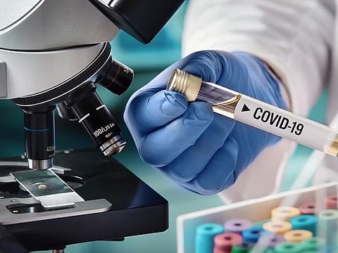 The British Government has ordered 100 million doses of the Oxford vaccine, although Prof Sarah Gilbert, who is leading the team at the front of the global race to develop a coronavirus vaccine, warns there remains a long way to go 