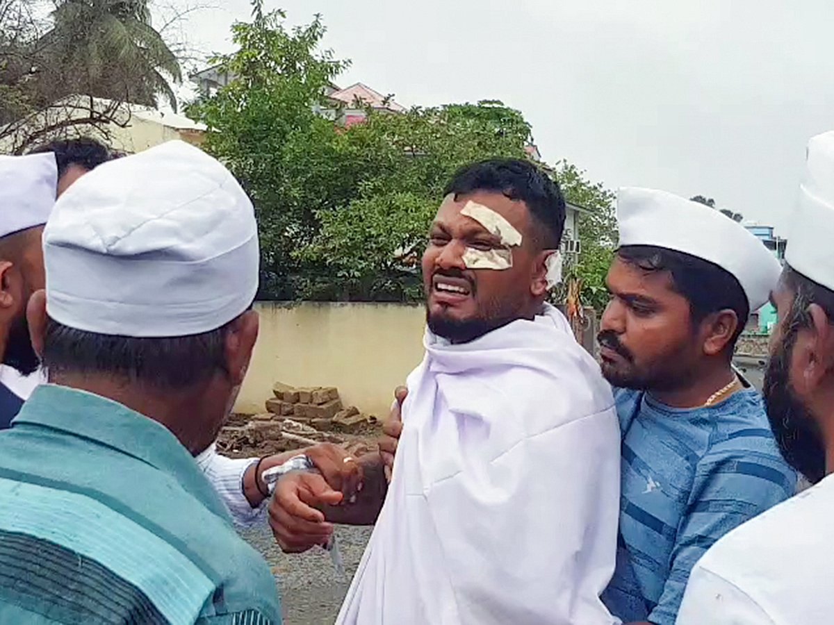 Air India crash survivor Vishwas Ramesh discharged from hospital- Video