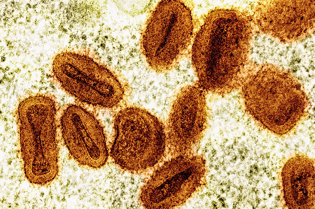 2 scientists charged with bringing deactivated mpox virus into the US and lying to authorities