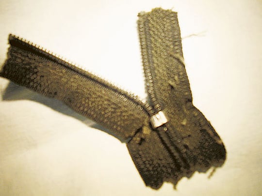 Painful zipper trauma for six-year-old boy