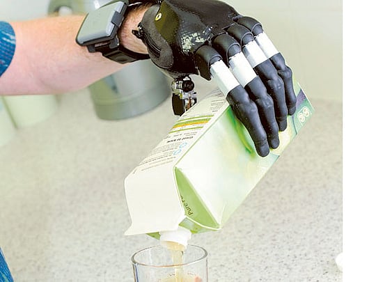 Mind-controlled hand offers hope for the paralysed