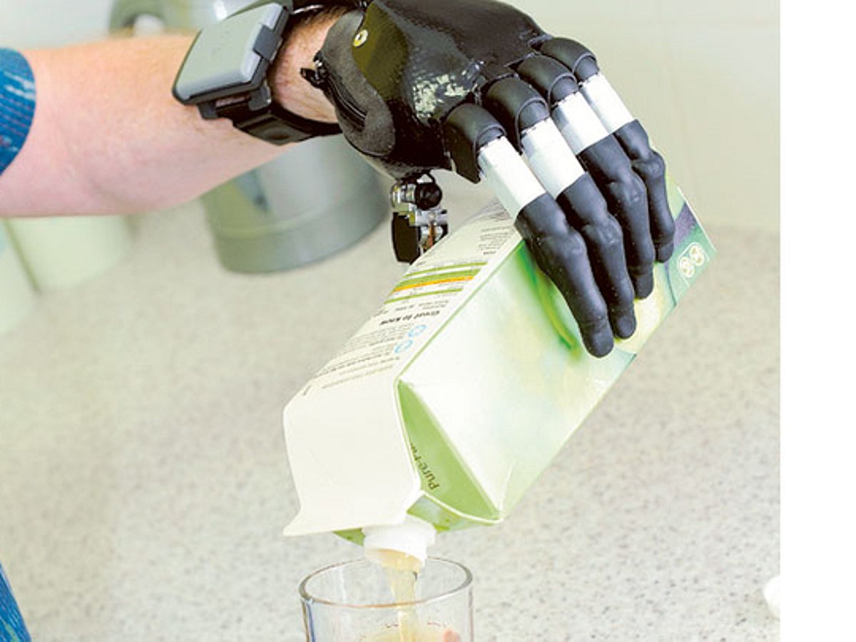 Brain Controlled Hand Mind-controlled hand offers hope for the paralysed