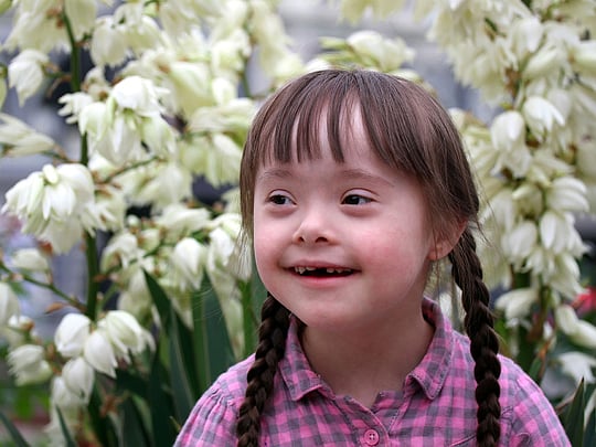 Inclusion still lacking for Down syndrome-hit children in UAE