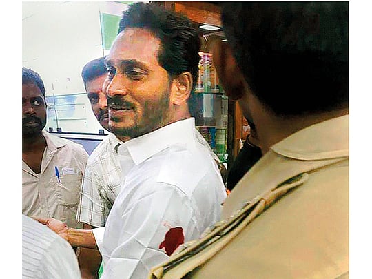 Jaganmohan Reddy injured in knife attack at Vizag airport