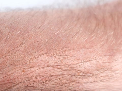 hairy skin