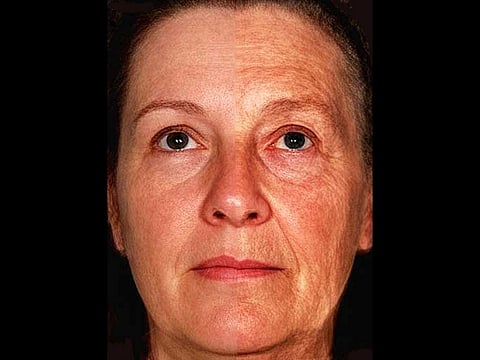 aging face composite