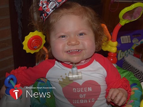 Baby Born With \'One-of-a-Kind\' Heart Receives Transplant