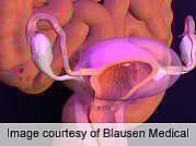 Young Age at Menarche Doesn't Equate to Earlier Sex