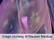 J&J Pulls Morcellator Devices From Market