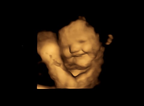 OneTimeBabyScan