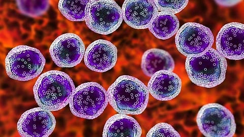Risk Stratification Can Predict Outcomes for CAR T-Cell Therapy in Lymphoma