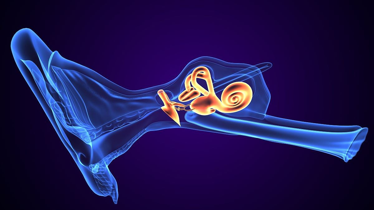 Vestibular Neurectomy Effective for Meniere Disease