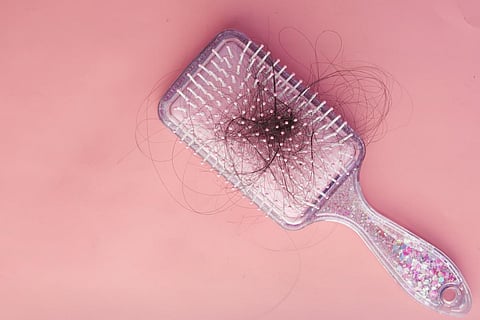 hair brush alopecia