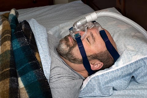 man sleeps on back with nasal mask from CPAP machine